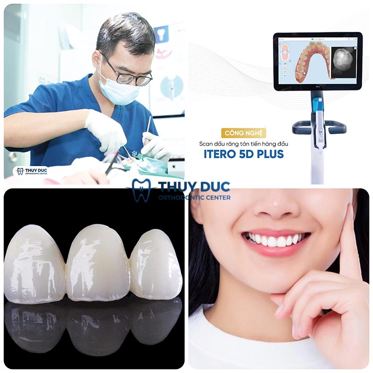 Porcelain crowns at Thuy Duc dental clinic 1