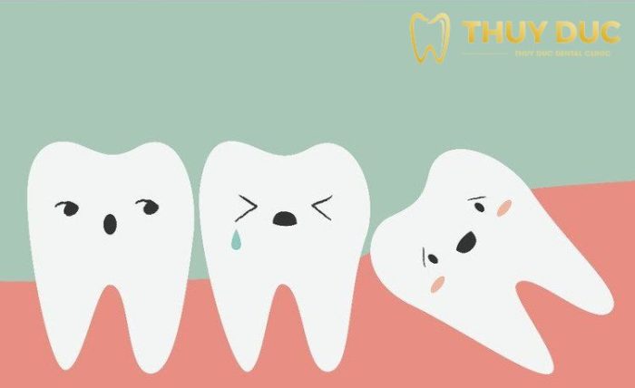 Tooth Extraction 1