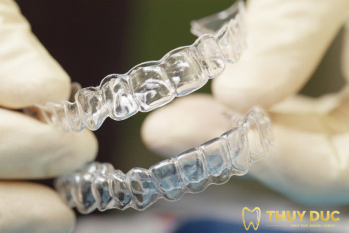 Advantages and disadvantages of Invisalign clear braces 1