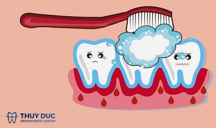 3. Should you brush your teeth if you have dengue fever? 1