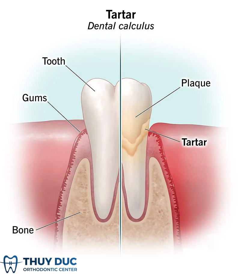 Cause of the disease 1