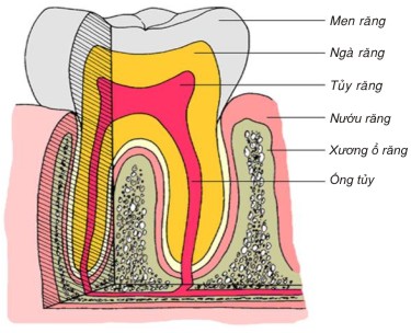 Có cần lấy tủy răng trước khi bọc răng sứ không?